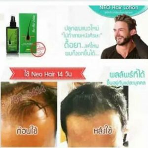 Neo Hair Lotion Natural Herb 100% Hair Treatment hair Root Nutrients 120 ml 2