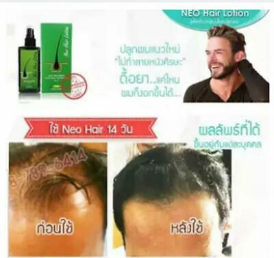 Neo Hair Lotion Natural Herb 100% Hair Treatment hair Root Nutrients 120 ml 2