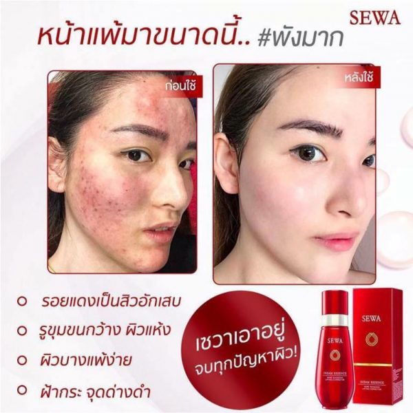 SEWA INSAM ESSENCE Reduce wrinkle, Fit & firm skin Whitening Aura 120 ml 8