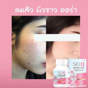 Gluta SoQ Collagen 10000 mg Whitening skin Reduces dark spots freckles A+ 8