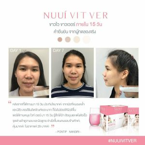 Nuui Vit Ver Collagen Tripeptide 10,000 mg Whitening Skin Tightens pores 4